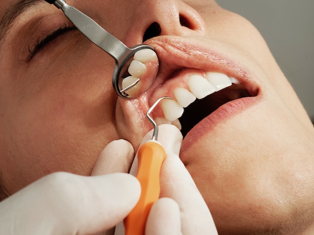 periodoncia-tenerife