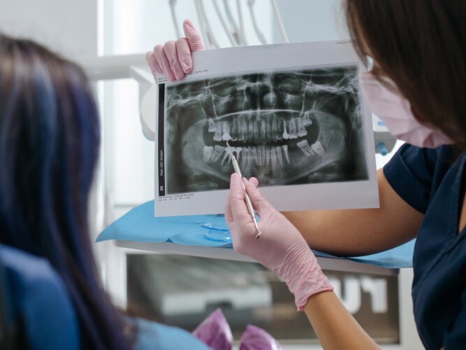 periodoncia-tenerife